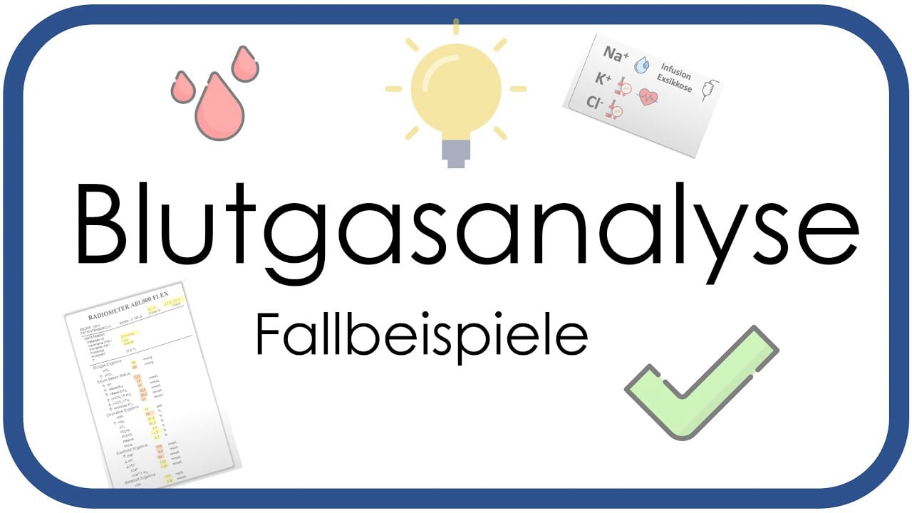 Videovorschau
